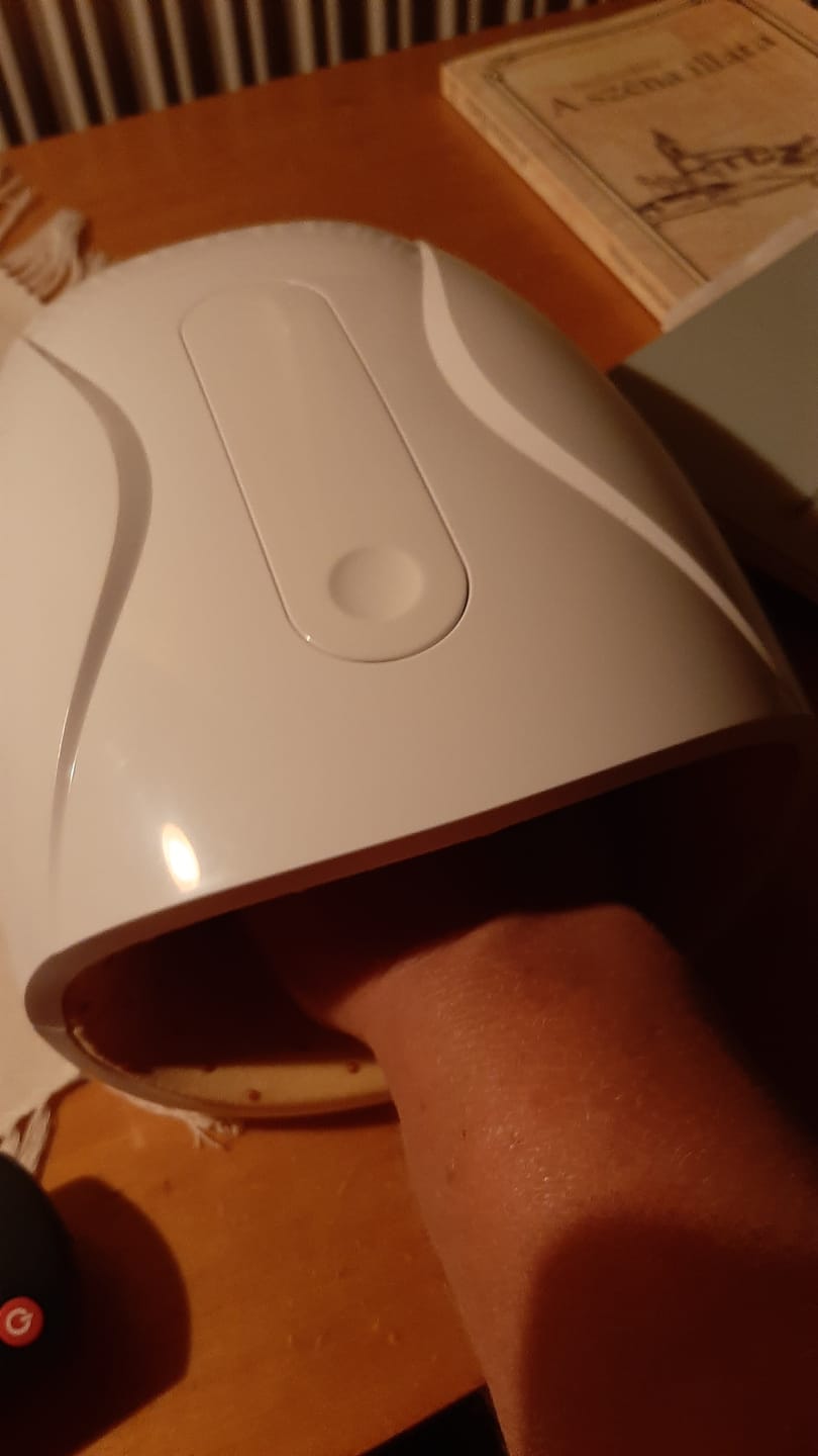 Customer photo review of HandCare+ Regeneráló Kézmasszírozó