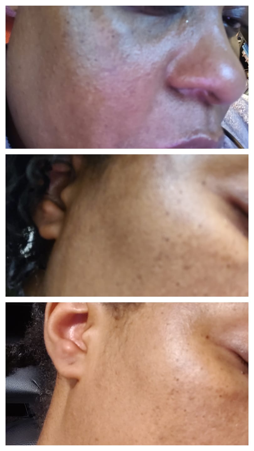 Customer photo review of Jolie’s Full Body & Face Brightening Kit