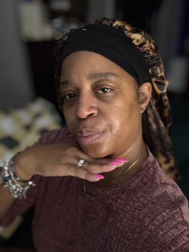 Customer photo review of 2IN1 DOUBLE CLEANSING BAR | ACNE RELIEF | DISCOLORATION CORRECTOR