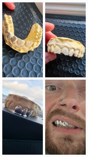 Customer photo review of Front & Lateral & Canine