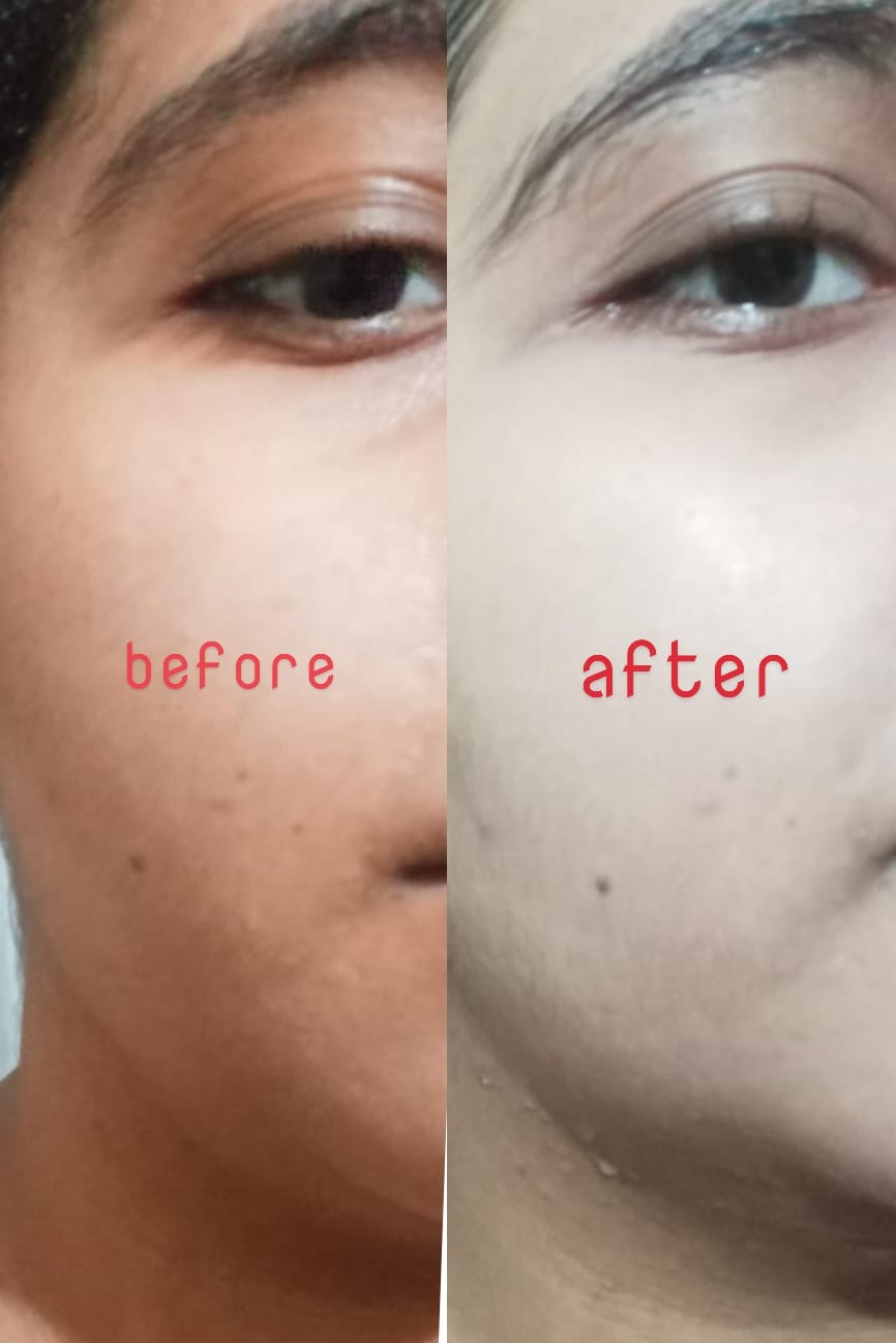 Customer photo review of Spectra Matt SC SPF 40