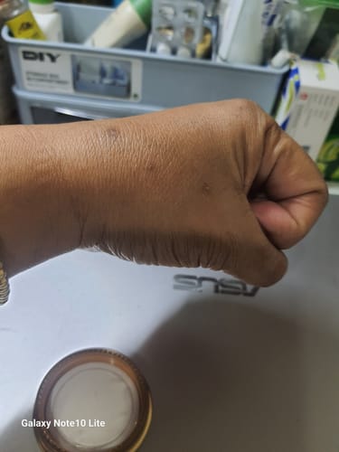 Customer photo review of Jolicare Cream
