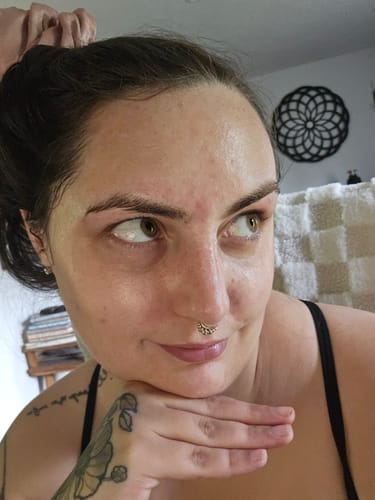 Customer photo review of Vivier Retinol 0.3%