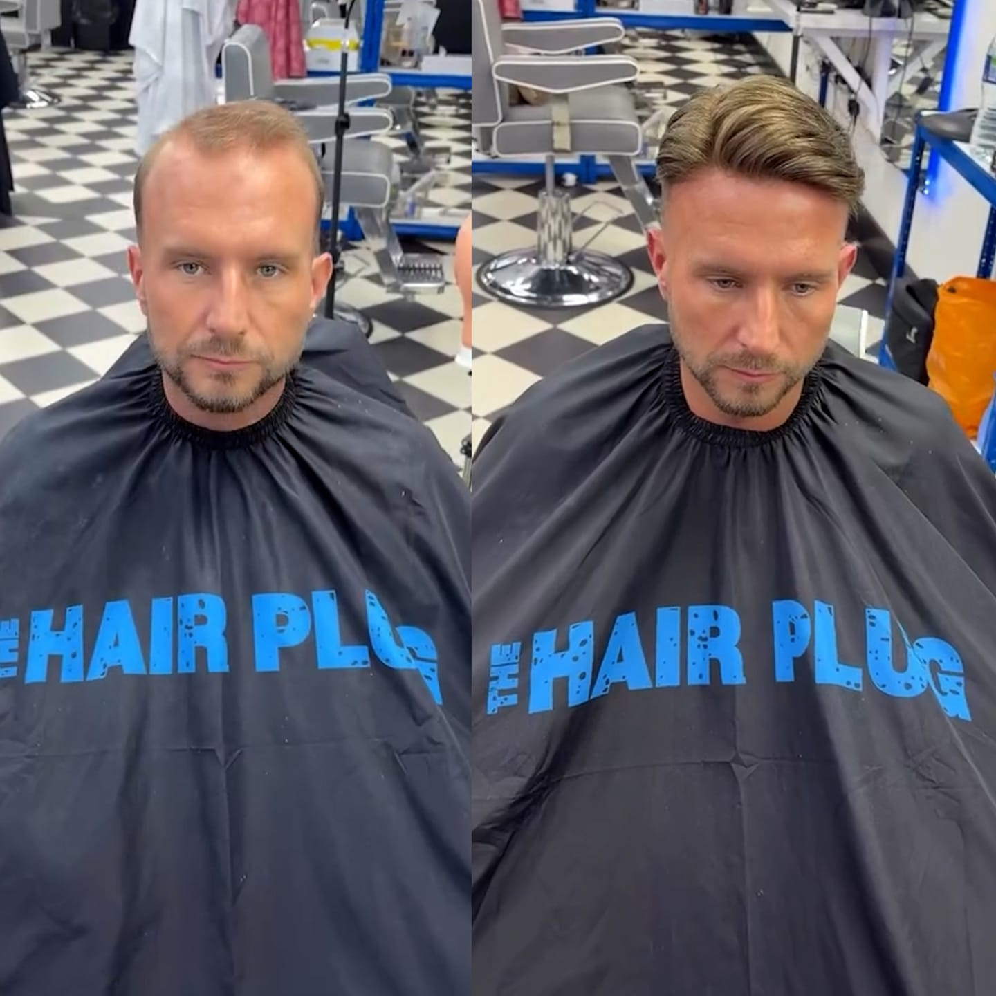 Customer photo review of Men Toupee Hero Full Swiss Mono hair system