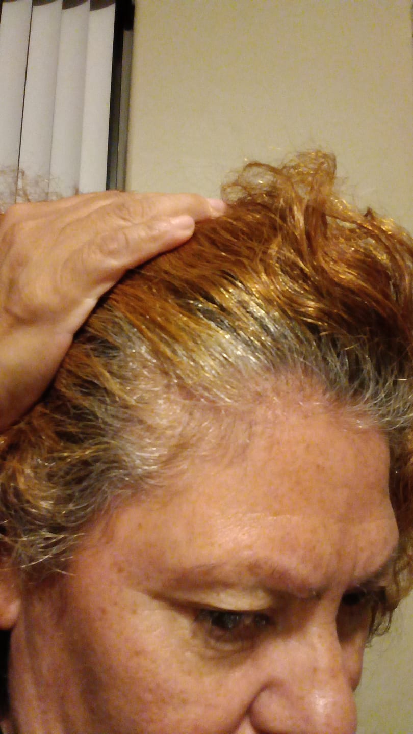 Customer photo review of Veganic Natural Hair Growth Oil