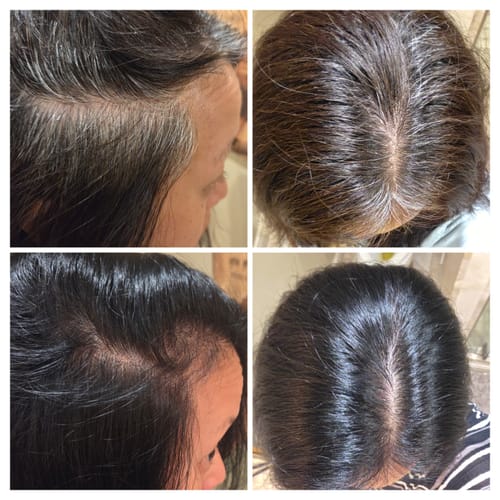 Customer photo review of Order Shipping Protection & Insurance