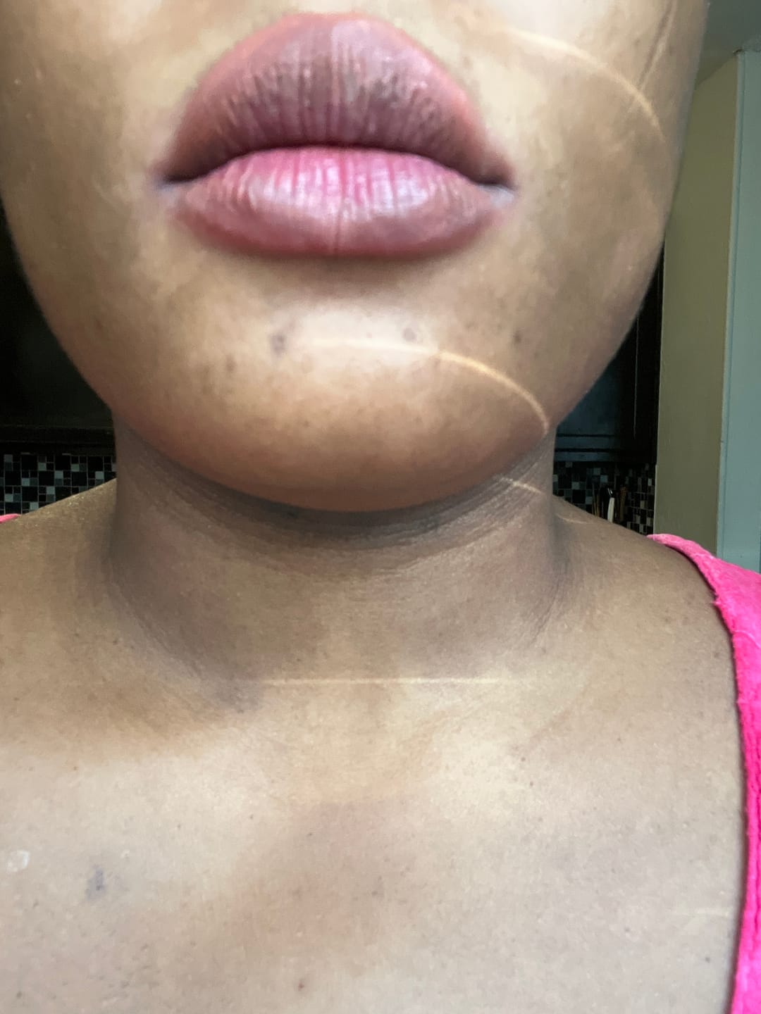 Customer photo review of Lips Lightening Cream For Men and Women (Results in 5 Days or Less)