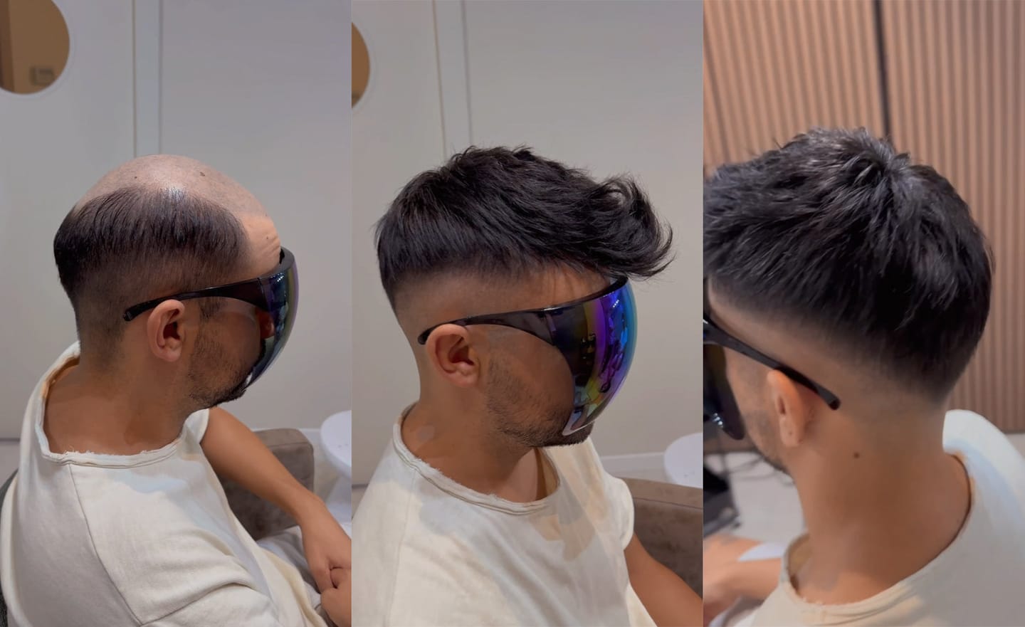 Customer photo review of Men Toupee Ace Full Frech Lace hair system
