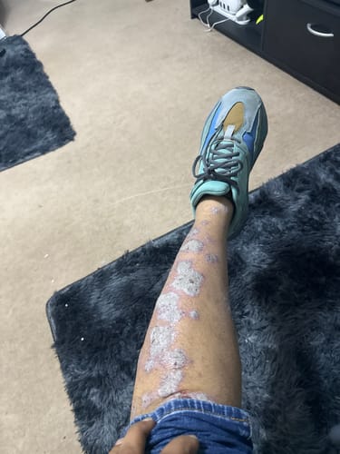 Customer photo review of Seb Natural Calming Serum