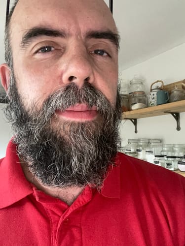 Customer photo review of Seb Natural Calming Serum