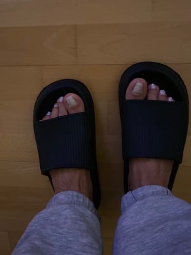 Customer photo review of Orthopädischer Hausschuh Cloudly™