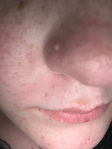 Customer photo review of Clear Corkscrew Nostril Piercing Retainer