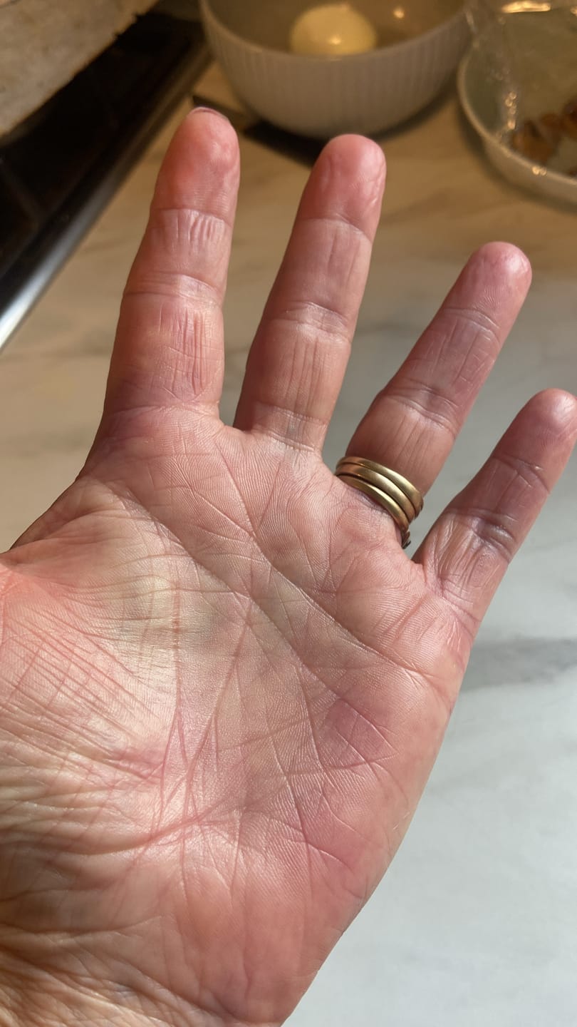 Customer photo review of Bioskin Duo Pack