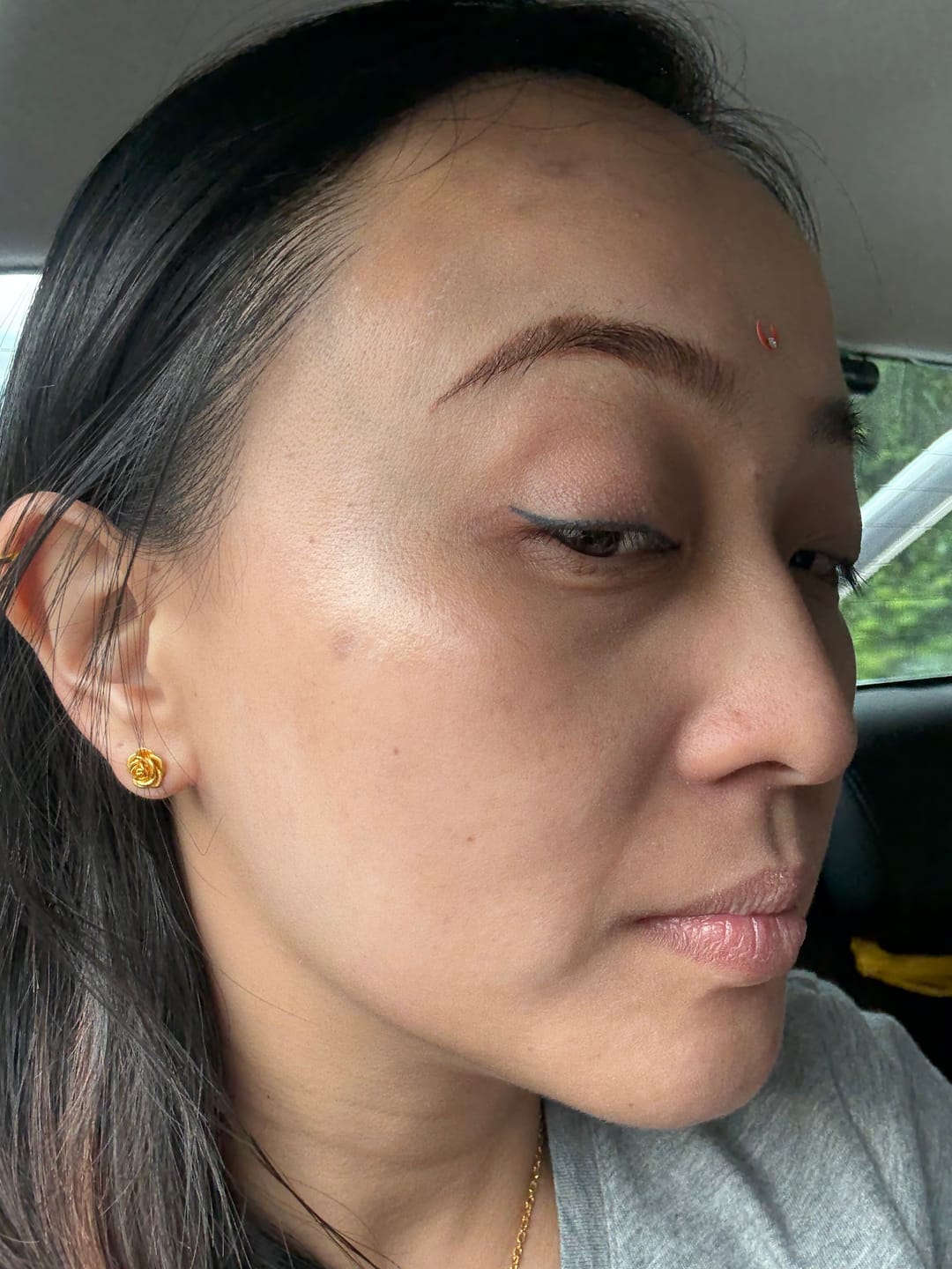 Customer photo review of Ventamin Light Up: Doctor-Formulated Oral Skincare