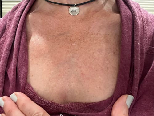 Customer photo review of Besque™ Magic Body Oil - 100ml