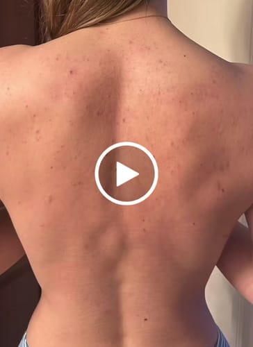 Customer video review of Skin Clearing Honey & Turmeric Bar