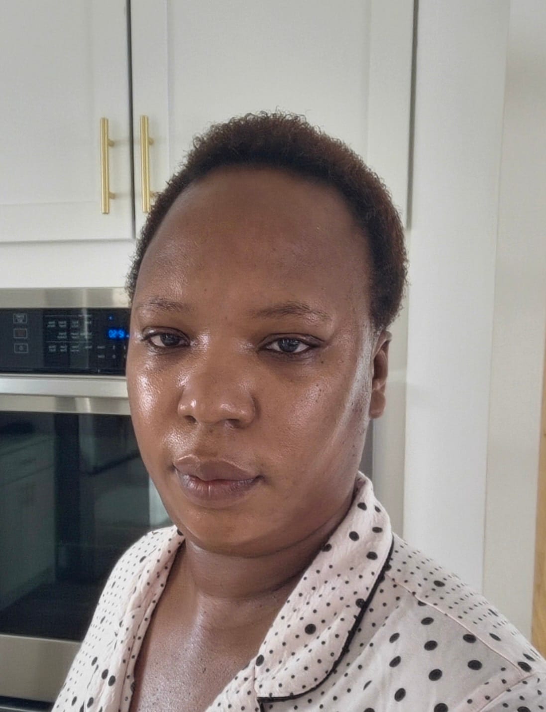 Customer photo review of Dark Spots  & Glow combo