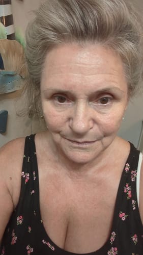 Customer photo review of Grass Fed Tallow & Honey Balm