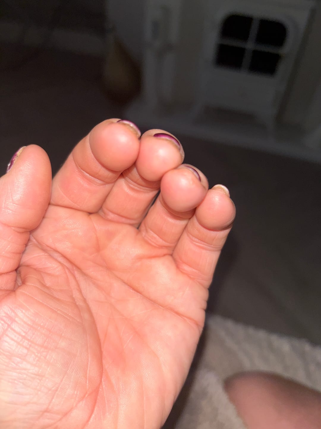 Customer photo review of Bioskin Zeoderm Skin Repair Moisturiser