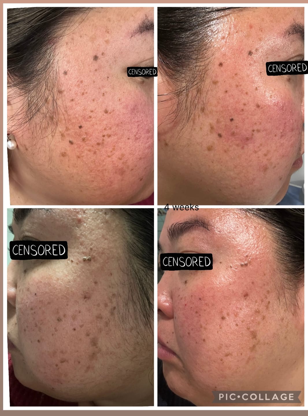 Customer photo review of MAGNESIUM SUPER STICK