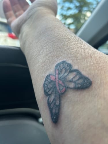 Customer photo review of TattooNumbx Numbing Cream