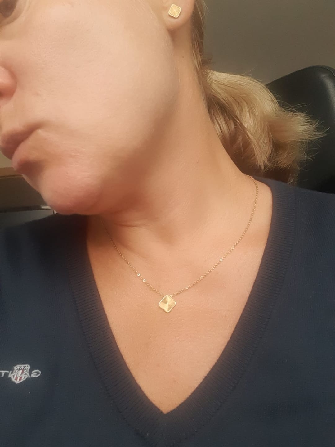 Customer photo review of Flora Gold Set