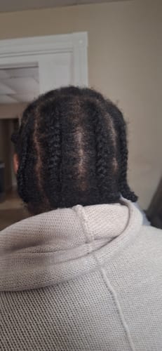 Customer photo review of Herbal Hair Growth Oil