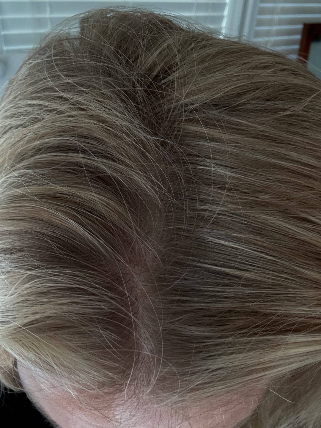 Customer photo review of 30 Day Hair Goals Supplement Bundle