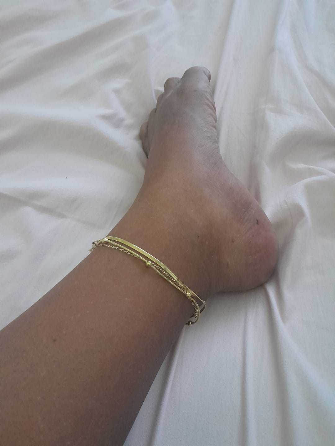 Customer photo review of Tornozeleira Dupla Ball Banhada em Ouro 18K