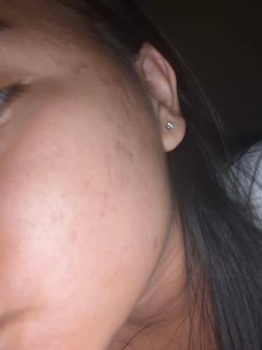 Customer photo review of 345 Relief Cream