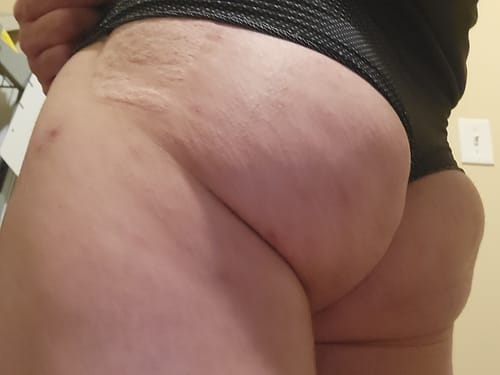 Customer photo review of "Big Booty Judy" Butt & Hip Enhancement Cream