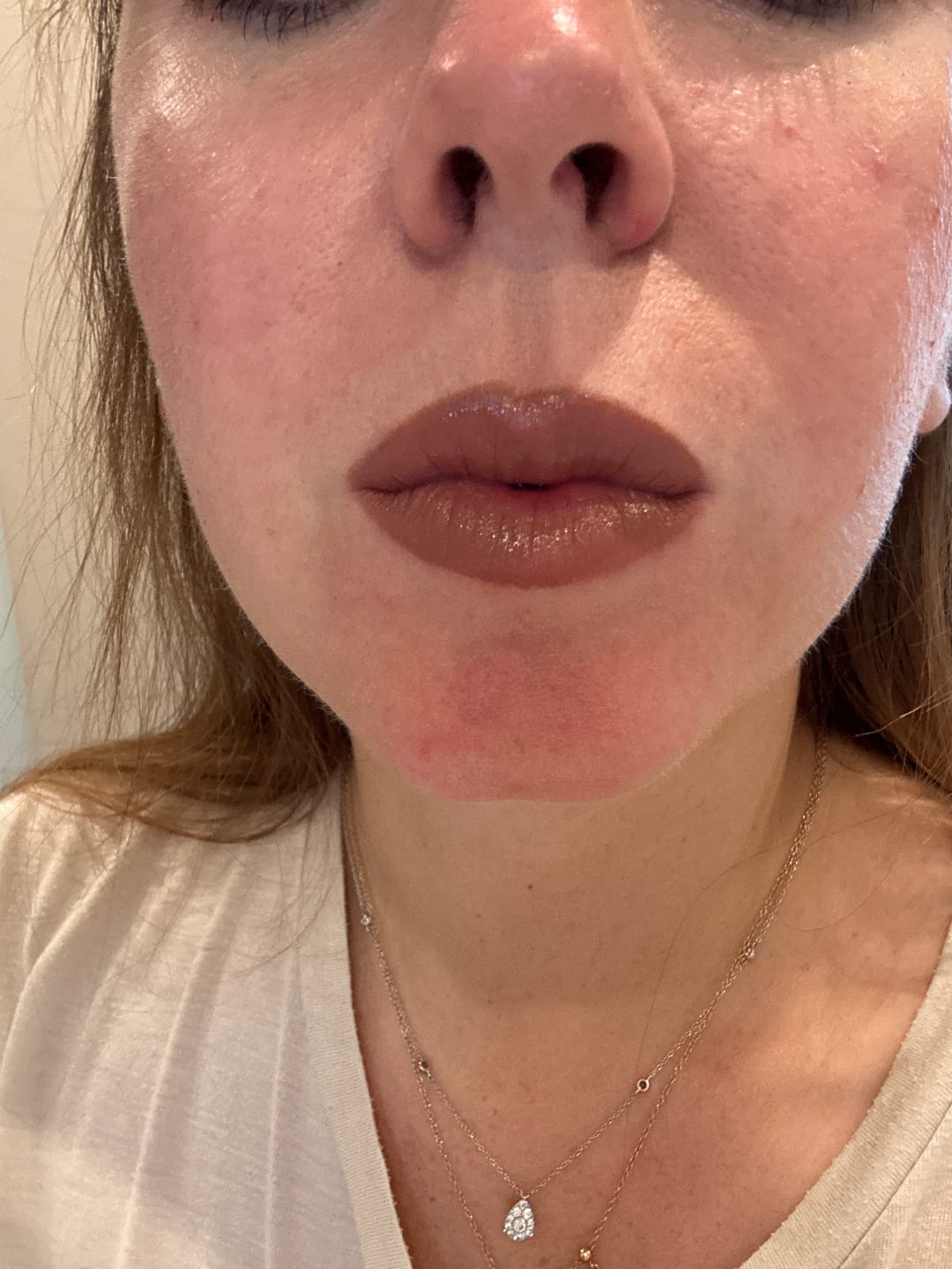 Customer photo review of Lip Over