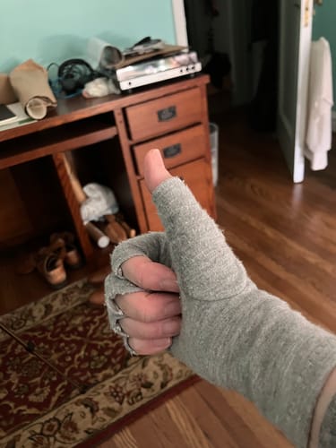 Customer photo review of Premium Onecompress™ Gloves