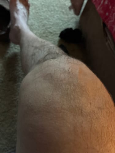 Customer photo review of RECOVER [Ultra Wound Support]
