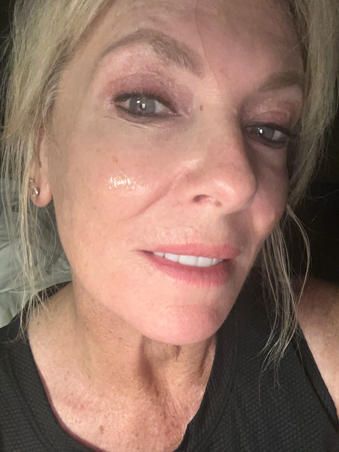Customer photo review of Collagen eye patch Jericho rose jelly