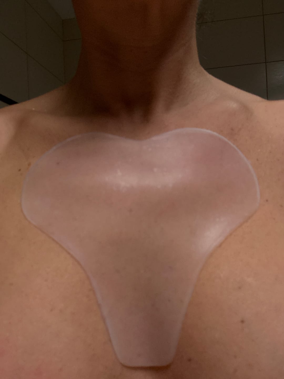 Customer photo review of Decolleté Pad mit Hyaluron