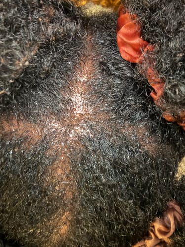 Customer photo review of ❗️RESTOCKED❗️ Bare Batana: Honduran imported RAW UNREFINED Batana Oil | 4oz & 6oz