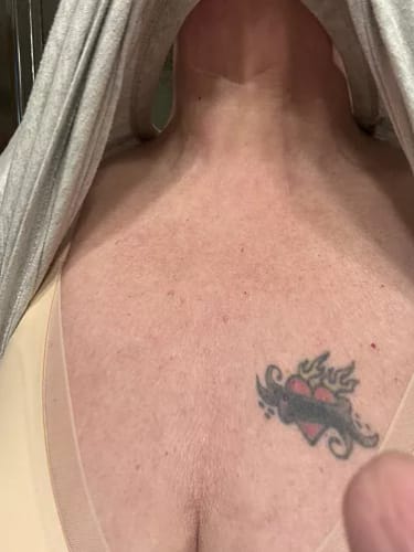 Customer photo review of ⁠Serum para el Cuello y brazos - 100ml