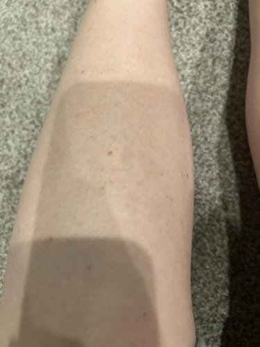 Customer photo review of PureSkin Ultra 9