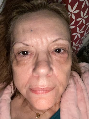 Customer photo review of Optimal Collagen Plus
