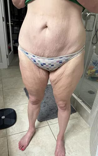 Customer photo review of ⁠Crema para la panza - 50ml