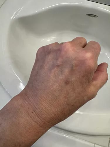 Customer photo review of ⁠Serum para el Cuello y brazos - 100ml