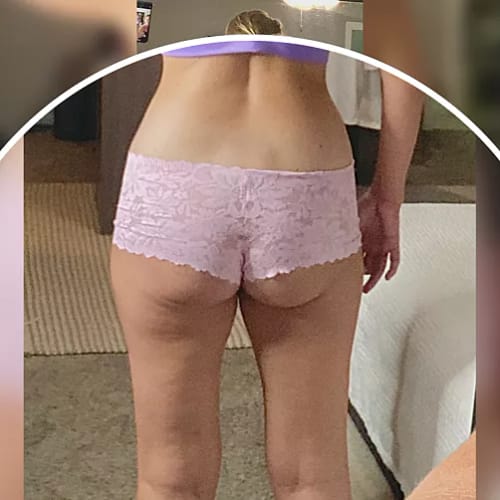 Customer photo review of ⁠ ⁠Serum para las Celulitis - 30 ml