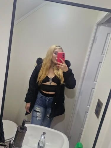 Customer photo review of PureSkin Ultra 9