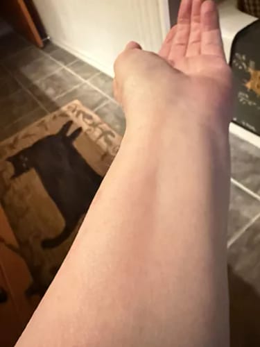 Customer photo review of ⁠Serum para el Cuello y brazos - 100ml