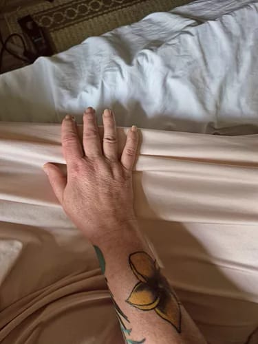 Customer photo review of ⁠Serum para el Cuello y brazos - 100ml