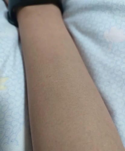 Customer photo review of PureSkin Ultra 9