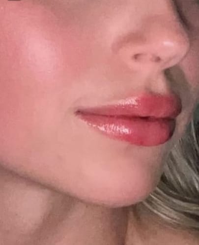 Customer photo review of Voluminizador de Lábios GLUMI