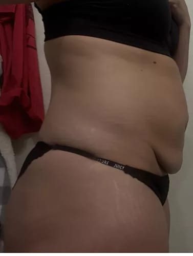 Customer photo review of ⁠Crema para la panza - 50ml