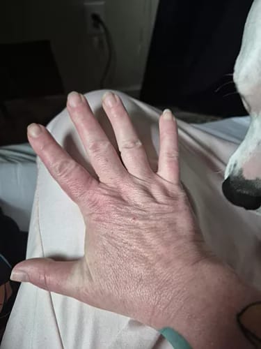 Customer photo review of ⁠Serum para el Cuello y brazos - 100ml